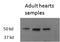 Thyroid Hormone Receptor Beta antibody, MBS420704, MyBioSource, Western Blot image 