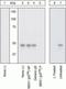 Mitogen-Activated Protein Kinase Kinase 1 antibody, GTX25613, GeneTex, Western Blot image 