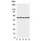 SDC3 antibody, R31248, NSJ Bioreagents, Western Blot image 