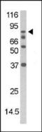 Death Domain Associated Protein antibody, PA5-12582, Invitrogen Antibodies, Western Blot image 