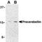 Cerebellin 1 Precursor antibody, LS-C19528, Lifespan Biosciences, Western Blot image 