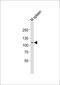 MER Proto-Oncogene, Tyrosine Kinase antibody, M00489-1, Boster Biological Technology, Western Blot image 