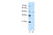 Zinc Finger Protein 488 antibody, 29-162, ProSci, Western Blot image 