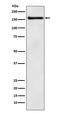 Coatomer Protein Complex Subunit Alpha antibody, M03987, Boster Biological Technology, Western Blot image 