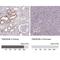 Transmembrane Protein 52B antibody, NBP2-49272, Novus Biologicals, Immunohistochemistry paraffin image 