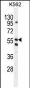 Leucine Rich Repeat, Ig-Like And Transmembrane Domains 1 antibody, PA5-71531, Invitrogen Antibodies, Western Blot image 