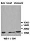 TNF Receptor Superfamily Member 12A antibody, orb77263, Biorbyt, Western Blot image 