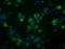 Fumarylacetoacetate Hydrolase Domain Containing 2A antibody, LS-C114994, Lifespan Biosciences, Immunofluorescence image 
