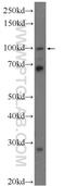 Ring Finger Protein 31 antibody, 16289-1-AP, Proteintech Group, Western Blot image 