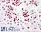 p53 antibody, LS-B7723, Lifespan Biosciences, Immunohistochemistry paraffin image 