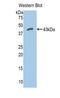 Complement Factor B antibody, LS-C304785, Lifespan Biosciences, Western Blot image 