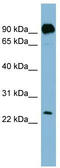 Proline Rich And Gla Domain 1 antibody, TA335270, Origene, Western Blot image 