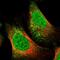 Trinucleotide Repeat Containing 18 antibody, NBP2-30515, Novus Biologicals, Immunofluorescence image 