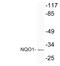 NAD(P)H Quinone Dehydrogenase 1 antibody, LS-C177292, Lifespan Biosciences, Western Blot image 