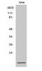 S100 Calcium Binding Protein A10 antibody, A02787, Boster Biological Technology, Western Blot image 