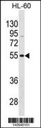Vasoactive Intestinal Peptide Receptor 1 antibody, 60-670, ProSci, Western Blot image 
