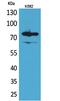 Forkhead Box P1 antibody, PA5-51087, Invitrogen Antibodies, Western Blot image 