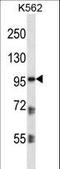 Plakophilin 2 antibody, LS-C163752, Lifespan Biosciences, Western Blot image 