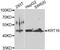 Keratin 16 antibody, STJ29629, St John