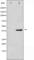 Eukaryotic Translation Initiation Factor 2 Subunit Alpha antibody, abx010699, Abbexa, Western Blot image 