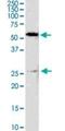 Glutathione S-Transferase Mu 4 antibody, H00002948-M01, Novus Biologicals, Western Blot image 