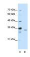 Exosome Component 3 antibody, orb324904, Biorbyt, Western Blot image 