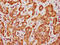 FKBP51 antibody, CSB-PA008700EA01HU, Cusabio, Immunohistochemistry paraffin image 
