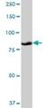 Procollagen-Lysine,2-Oxoglutarate 5-Dioxygenase 3 antibody, H00008985-B01P, Novus Biologicals, Western Blot image 