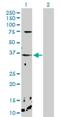 Calcium-binding protein p22 antibody, H00011261-D01P, Novus Biologicals, Western Blot image 