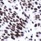 ERCC Excision Repair 1, Endonuclease Non-Catalytic Subunit antibody, MA5-16361, Invitrogen Antibodies, Immunohistochemistry paraffin image 