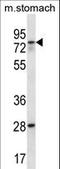 Polypeptide N-Acetylgalactosaminyltransferase 17 antibody, LS-C157362, Lifespan Biosciences, Western Blot image 