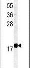 Transmembrane Protein 222 antibody, PA5-25054, Invitrogen Antibodies, Western Blot image 