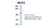 Jumonji Domain Containing 4 antibody, 25-129, ProSci, Western Blot image 