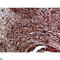 Ret Proto-Oncogene antibody, LS-C813551, Lifespan Biosciences, Immunohistochemistry paraffin image 