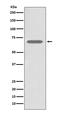 Adrenoceptor Beta 2 antibody, M00072, Boster Biological Technology, Western Blot image 