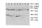 Interleukin 5 Receptor Subunit Alpha antibody, LS-C312774, Lifespan Biosciences, Western Blot image 