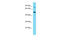 Choline transporter-like protein 2 antibody, ARP44009_P050, Aviva Systems Biology, Western Blot image 