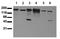 ERBB2 antibody, AM00052PU-N, Origene, Western Blot image 