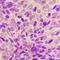 Ribosomal Protein S6 Kinase A6 antibody, LS-C358297, Lifespan Biosciences, Immunohistochemistry paraffin image 
