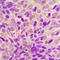 Ribosomal protein S6 kinase alpha-6 antibody, LS-C358297, Lifespan Biosciences, Immunohistochemistry paraffin image 