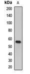 FGR Proto-Oncogene, Src Family Tyrosine Kinase antibody, LS-C667991, Lifespan Biosciences, Western Blot image 