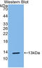 S100 Calcium Binding Protein A10 antibody, LS-C296300, Lifespan Biosciences, Western Blot image 