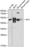 WT1 Transcription Factor antibody, GTX32972, GeneTex, Western Blot image 