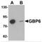 Guanylate Binding Protein Family Member 6 antibody, MBS150908, MyBioSource, Western Blot image 