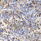 Ubiquitin Associated And SH3 Domain Containing B antibody, A7141, ABclonal Technology, Immunohistochemistry paraffin image 