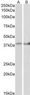 Isocitrate Dehydrogenase (NAD(+)) 3 Beta antibody, LS-C139804, Lifespan Biosciences, Western Blot image 