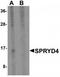 SPRY Domain Containing 4 antibody, TA320159, Origene, Western Blot image 
