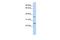 IQ Motif Containing F1 antibody, GTX45663, GeneTex, Western Blot image 