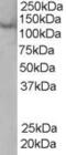 Rabenosyn, RAB Effector antibody, TA302887, Origene, Western Blot image 