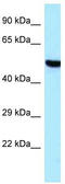 Threonyl-TRNA Synthetase 2, Mitochondrial antibody, TA343261, Origene, Western Blot image 